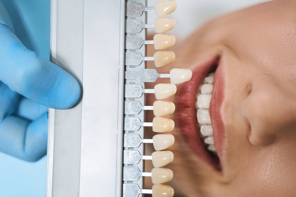 Immagine che illustra Trio Dental Center, la migliore clinica per le faccette dentali in Albania.
