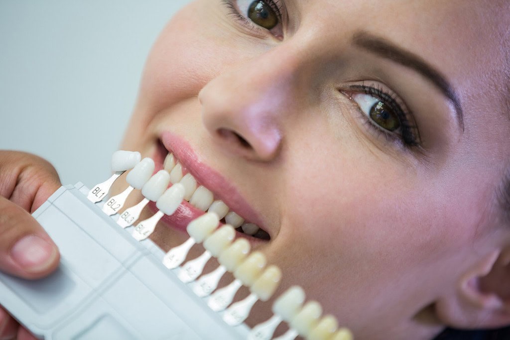 Immagine che illustra perché scegliere Trio Dental Center, la migliore clinica per le faccette dentali in Albania.