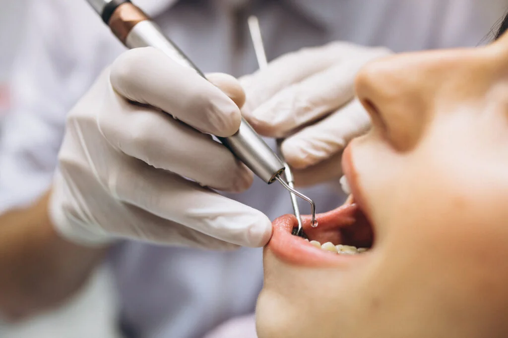 Immagine che illustra la necessità di un solo intervento, uno dei vantaggi dell'implantologia a carico immediato in Albania presso il Trio Dental Center.