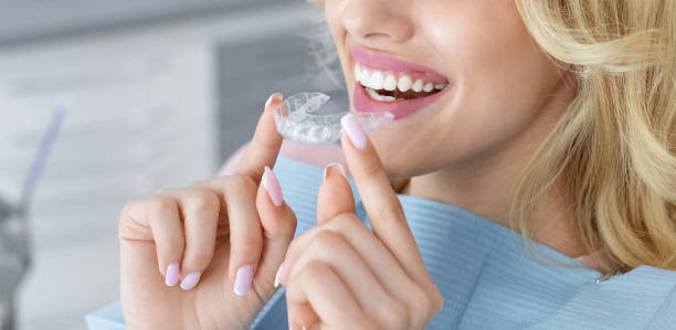 Mujer sonriendo sosteniendo un alineador dental transparente, mostrando dientes perfectos con cuidado ortodóntico.