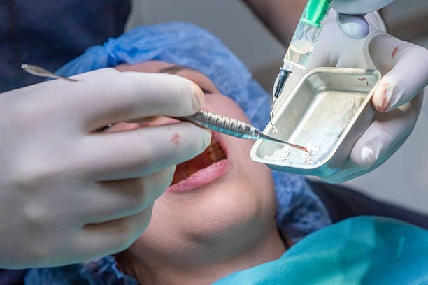 Dentist duke kryer procedurë dentare me mjete dhe shiringë në gojën e pacientit.