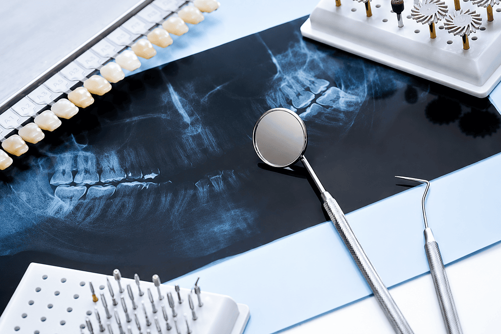 Radiografía dental con instrumental dental y guía de color de dientes para odontología restauradora y planificación de implantes.