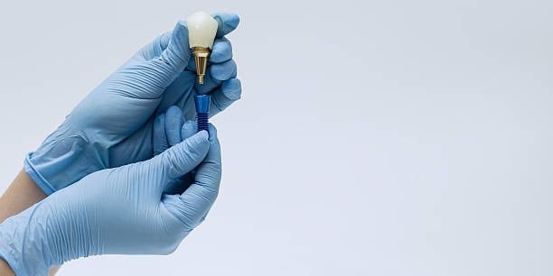 Gloved hands assembling dental implant on white background, emphasizing dental care and dentistry tools.