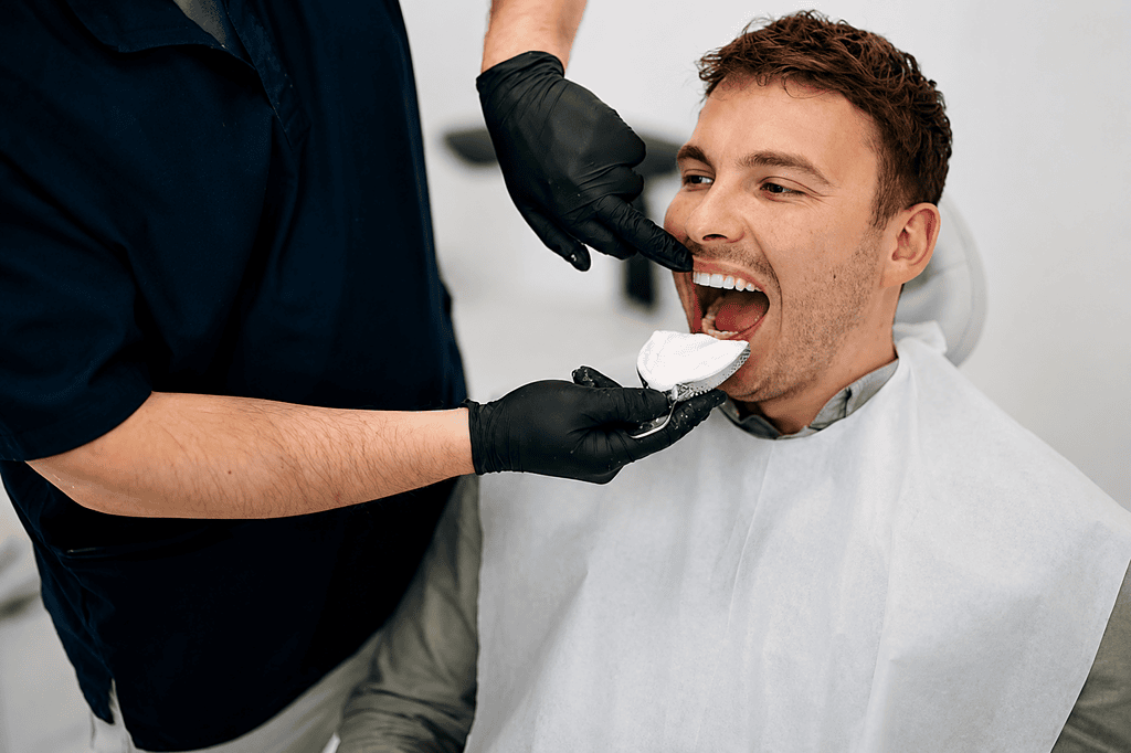 Dentist making an impression of a patient's teeth with dental tray and putty.